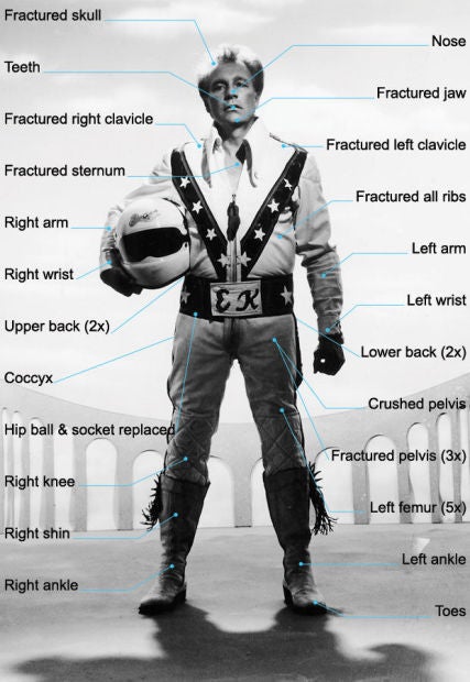 Evel Knievel Broken Bones motorcycle safety